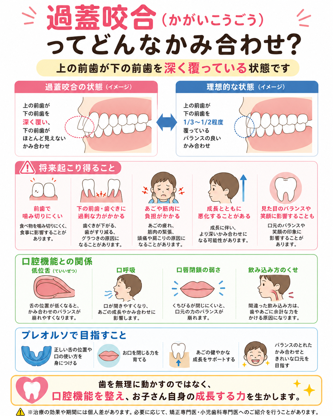 過蓋咬合の説明図