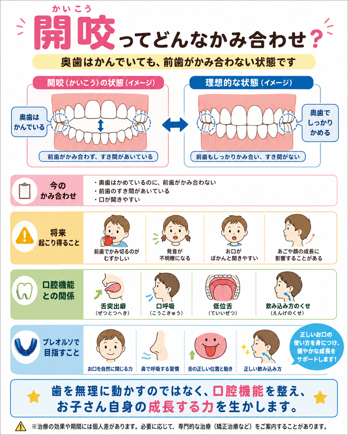 開咬の説明図