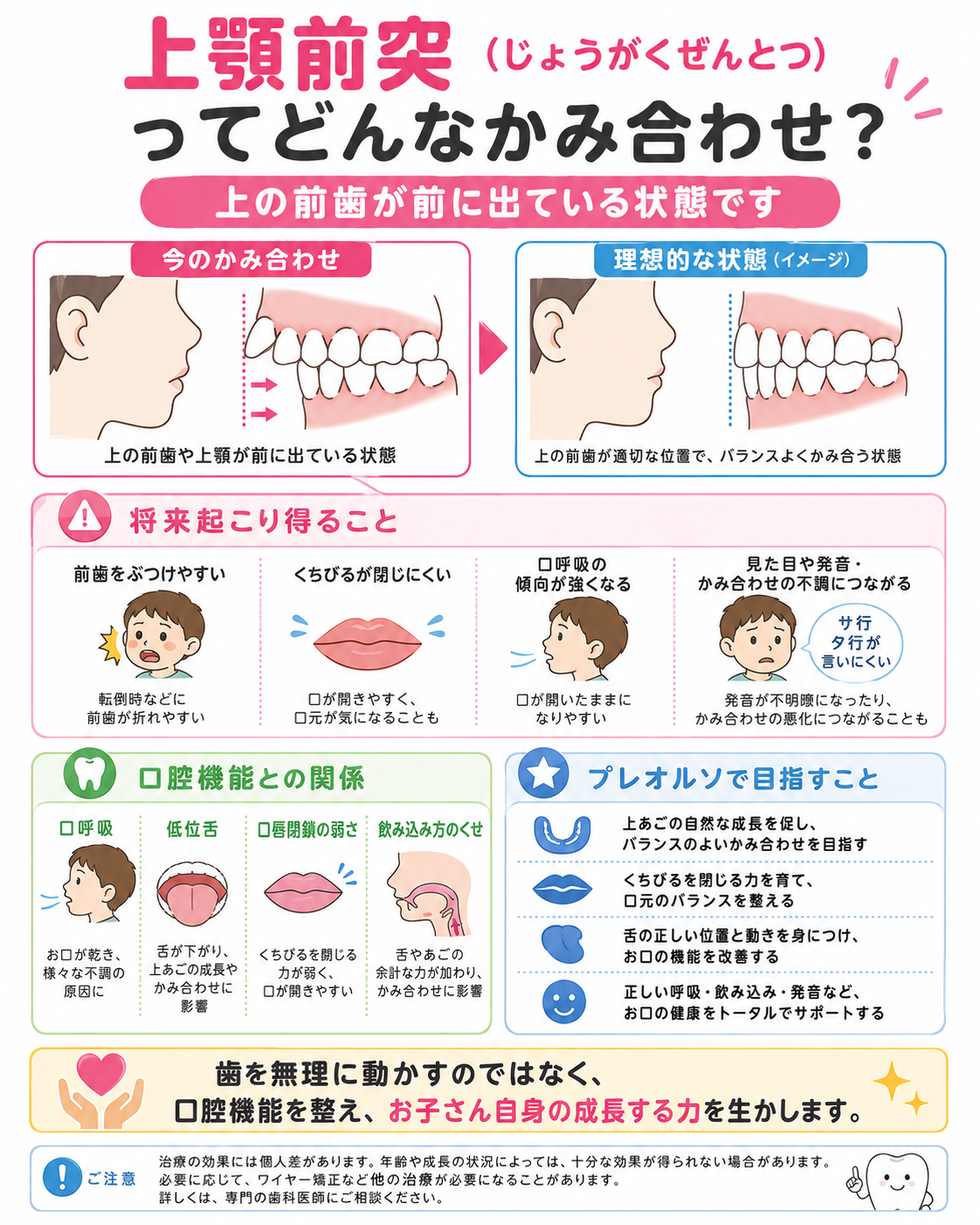 上顎前突の説明図