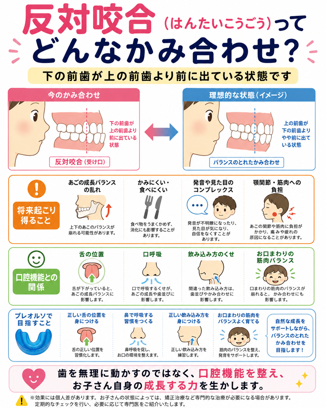 反対咬合の説明図